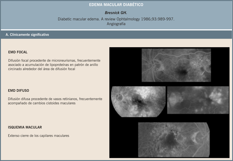 Articulo Oftalmologia 18468 articulo-oftalmologia-18468